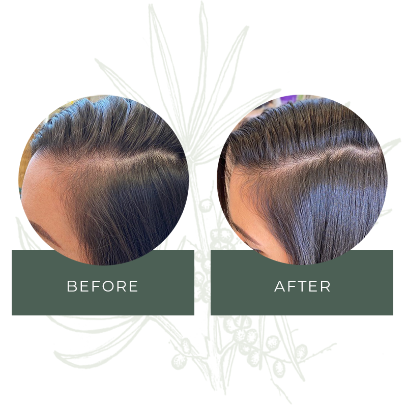 Manetane Real Results Before and After